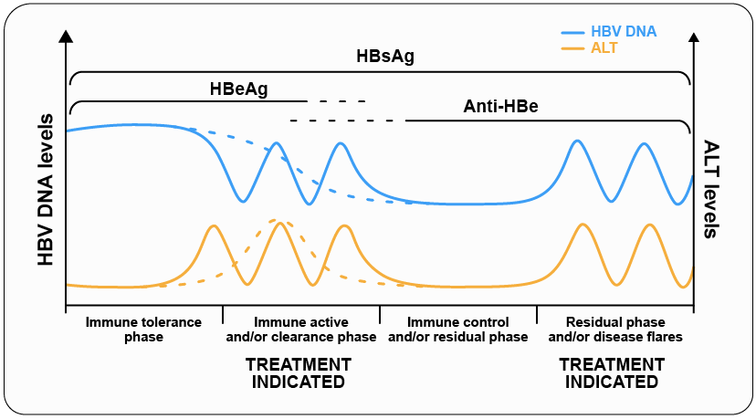 Chronic hepatitis B phases image Chronic hepatitis B phases